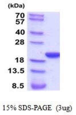 SDS-PAGE: Recombinant Rat Cyclophilin-F His Protein [NBP2-52132]