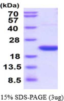 SDS-PAGE: Recombinant Rat Cyclophilin-F His Protein [NBP2-59540]