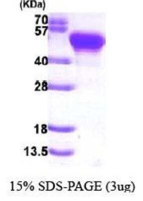 SDS-PAGE: Recombinant S. aureus Protein A Protein [NBP3-07005]