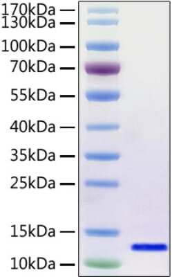 SDS-PAGE: Recombinant SARS-CoV-2 Envelope (Avi Epitope Tag) His (N-Term) Avi-tag Protein [NBP2-90986]