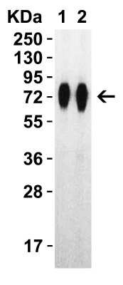 Western Blot: Recombinant SARS-CoV-2 Spike (RBD+SD1+SD2) His (C-Term) Protein [NBP3-07951]
