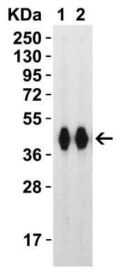 Western Blot: Recombinant SARS-CoV-2 Spike (RBD+SD1) His (C-Term) Protein [NBP3-07950]