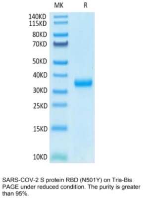 SDS-PAGE: Recombinant SARS-CoV-2 Spike RBD (N501Y) His Avi-tag Protein [NBP3-07930]