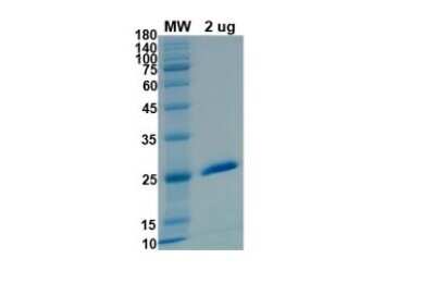 SDS-PAGE: Recombinant SARS-CoV-2 nsp3 His (N-Term) Protein [NBP3-07084]