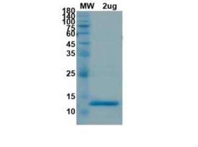 SDS-PAGE: Recombinant SARS-CoV-2 nsp9 His (N-Term) Protein [NBP3-07953]