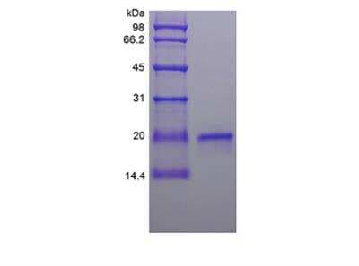 SDS-PAGE: Recombinant Sheep IFN-tau-1 Protein [NBP2-61440]