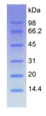 SDS-PAGE: Recombinant Unstained Protein Ladder (14-98 kDa) [NBP3-11649]