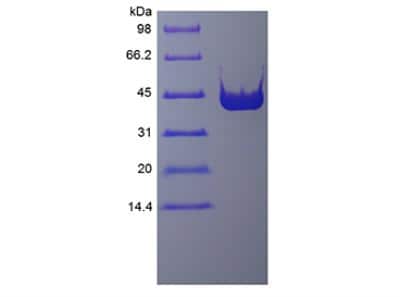 SDS-PAGE: Recombinant PreScission Protease Protein [NBP2-61442]