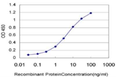ELISA: Recoverin Antibody (2H4) [H00005957-M05]