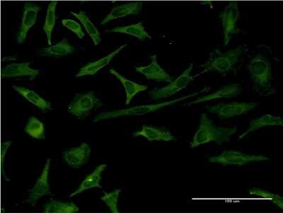 Immunocytochemistry/ Immunofluorescence: Recoverin Antibody (3F6) [H00005957-M37]