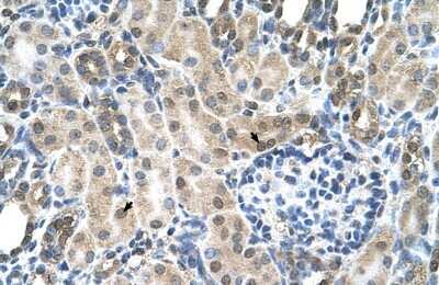 Immunohistochemistry-Paraffin: Reduced Folate Carrier/SLC19A1 Antibody [NBP1-59904]