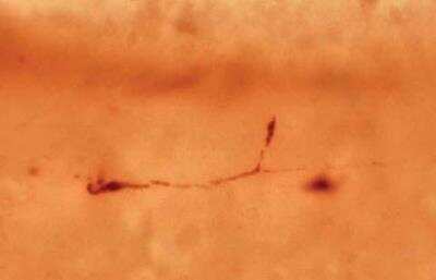 Immunohistochemistry: Reelin Antibody (142) - BSA Free [NB600-1080]