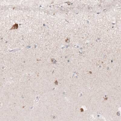 Immunohistochemistry-Paraffin: Reelin Antibody (CL5324) [NBP2-61414]