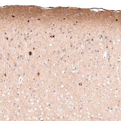 Immunohistochemistry-Paraffin: Reelin Antibody (CL5324) [NBP2-61414]