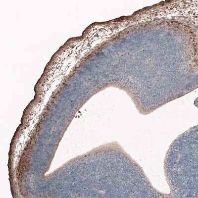 Immunohistochemistry-Paraffin: Reelin Antibody (CL5324) [NBP2-61414]