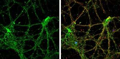 Immunocytochemistry/ Immunofluorescence: Reelin Antibody [NBP3-13177]