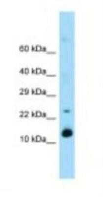 Western Blot: Reg1A Antibody [NBP1-98445]