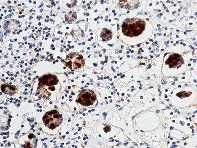 Immunohistochemistry-Paraffin: Reg3A Antibody (019) [NBP2-89856]