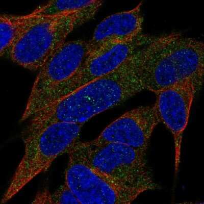Immunocytochemistry/ Immunofluorescence: Reg3A Antibody [NBP2-56285]