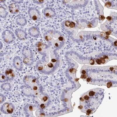 Immunohistochemistry-Paraffin: Reg4 Antibody [NBP2-38552]