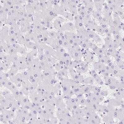 Immunohistochemistry-Paraffin: Reg4 Antibody [NBP2-38552]