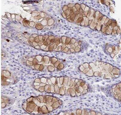 Immunohistochemistry-Paraffin: Reg4 Antibody [NBP2-38552]