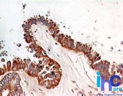 Immunohistochemistry-Paraffin: RelA/NFkB p65 Antibody (112A1021) - Azide and BSA Free [NBP2-27416]