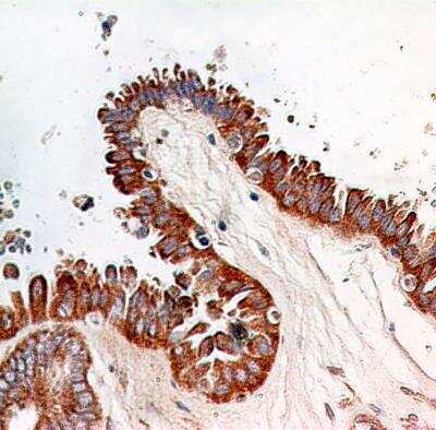 Immunohistochemistry-Paraffin: RelA/NFkB p65 Antibody (112A1021) - BSA Free [NB100-56712]