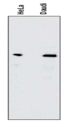 Western Blot: RelA/NFkB p65 Antibody (112A1021)BSA Free [NB100-56712]