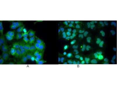 Immunocytochemistry/ Immunofluorescence: RelA/NFkB p65 Antibody (27F9.G4) [NBP1-77815]