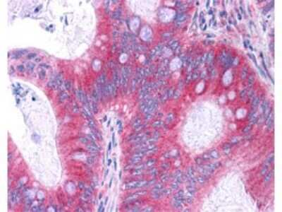 Immunohistochemistry: RelA/NFkB p65 Antibody (27F9.G4) [NBP1-77815]