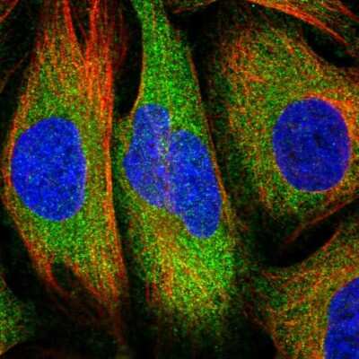 Immunocytochemistry/ Immunofluorescence: RelA/NFkB p65 Antibody [NBP2-56067]
