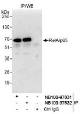 Immunoprecipitation: RelA/NFkB p65 Antibody [NB100-97831]