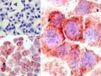 Immunohistochemistry-Paraffin: RelA/NFkB p65 NLS Antibody - BSA Free [NBP2-24541]