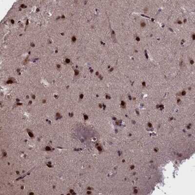 Immunohistochemistry-Paraffin: RelB Antibody [NBP2-34064]