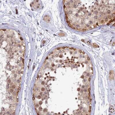 Immunohistochemistry-Paraffin: Relaxin-3 Antibody [NBP2-47308]