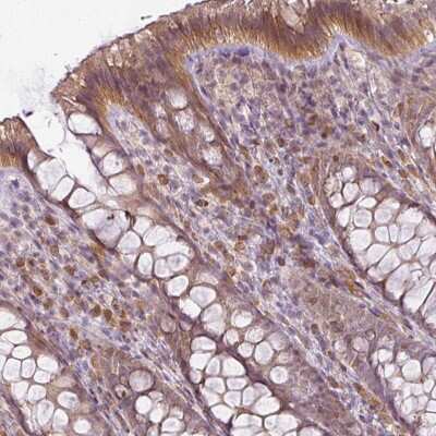 Immunohistochemistry: DEC-205/CD205 Antibody [NBP2-48926]