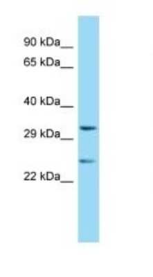 Western Blot: Renalase Antibody [NBP1-98475]