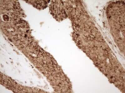 Immunohistochemistry: Renin Antibody (OTI2F10) [NBP2-45552]