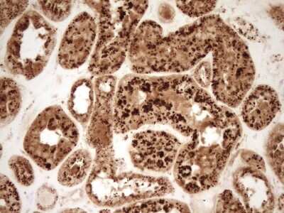 Immunohistochemistry: Renin Antibody (OTI2F10) [NBP2-45552]