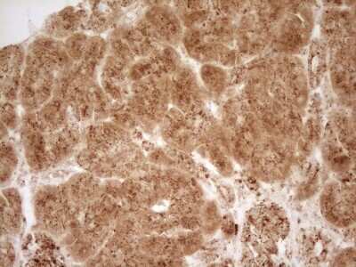 Immunohistochemistry: Renin Antibody (OTI2F10) [NBP2-45552]