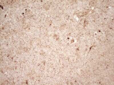 Immunohistochemistry: Renin Antibody (OTI2F10) [NBP2-45552]