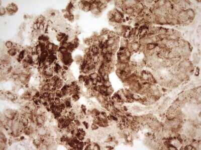 Immunohistochemistry: Renin Antibody (OTI2F10) - Azide and BSA Free [NBP2-73851]