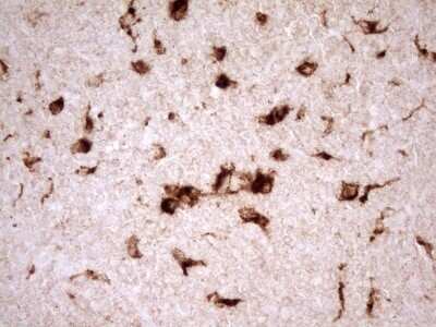 Immunohistochemistry: Renin Antibody (OTI2F10) - Azide and BSA Free [NBP2-73851]