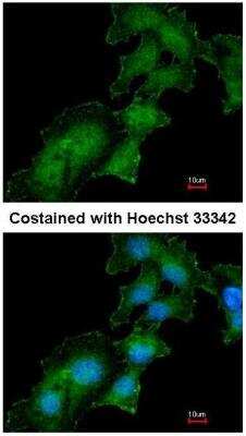 Immunocytochemistry/ Immunofluorescence: Renin R Antibody [NBP1-33605]