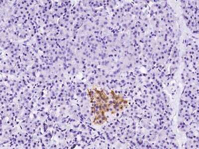 Immunohistochemistry-Paraffin: Renin R Antibody [NBP2-99111]