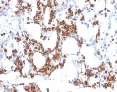 Immunohistochemistry-Paraffin: Resistin Antibody (RETN/3331) [NBP3-07242]