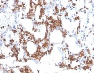 Immunohistochemistry-Paraffin: Resistin Antibody (RETN/3331) - Azide and BSA Free [NBP3-08250]