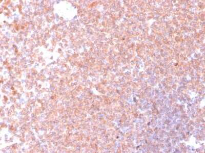 Immunohistochemistry-Paraffin: Resistin Antibody (RETN/4326) - Azide and BSA Free [NBP3-08258]