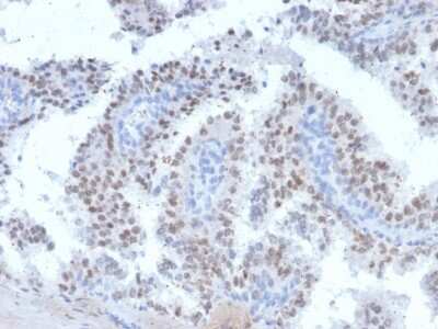 Immunohistochemistry-Paraffin: Ret Antibody (RET/2663) [NBP2-79761]